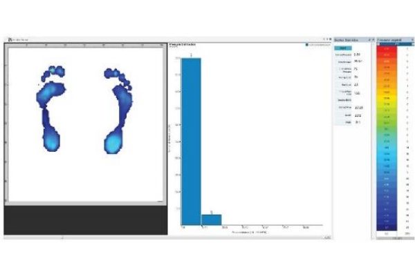 鞋垫式足底压力&步态测试系统X4 - 图片 5