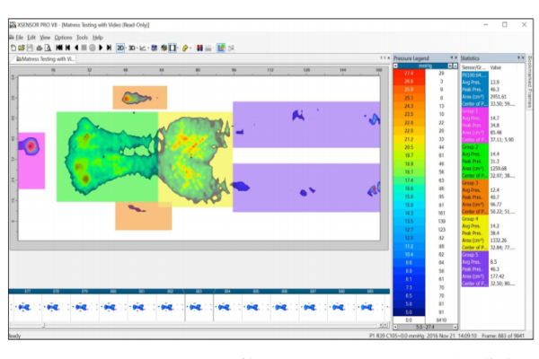 床垫式压力分布测试系统Xsensor Mattresses - 图片 3