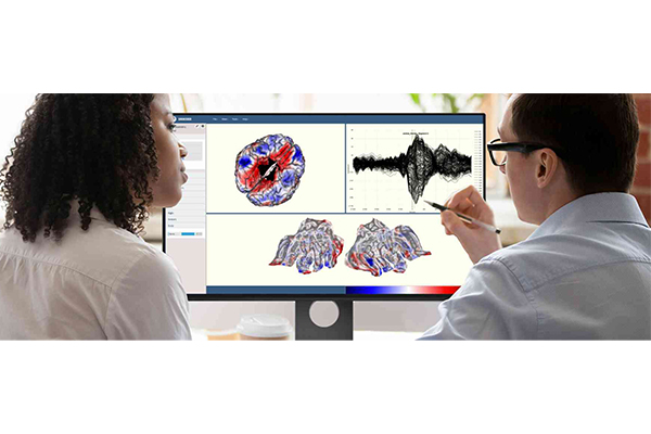 脑电图源定位系统SOURCERER - 图片 3