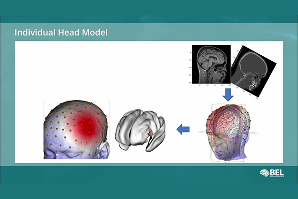 脑电图源定位系统SOURCERER - 图片 4