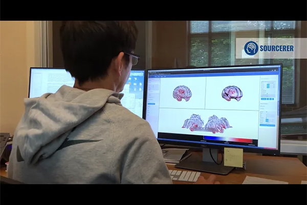 脑电图源定位系统SOURCERER - 图片 5